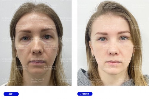 intimateplasty.ru.jpg